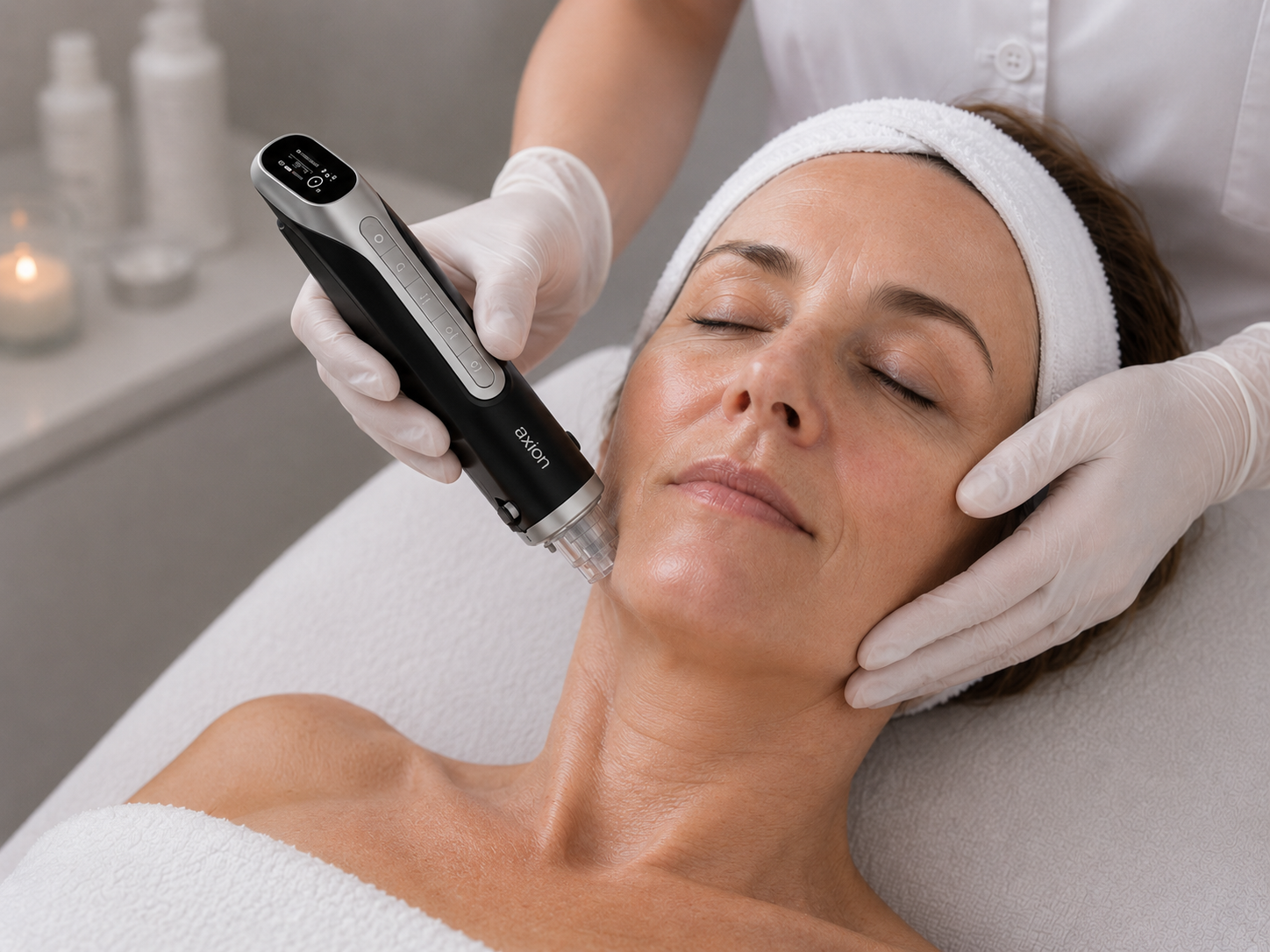 Microneedling PRO in Duisburg Behandlung bei Pirronello Hautkonzepte